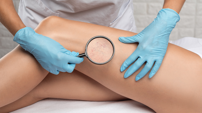Full-Body-Skin-Rejuvenation
