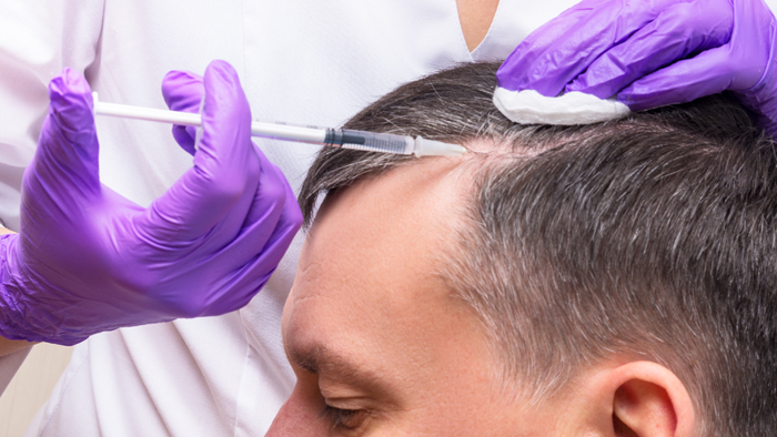 Mesotherapy